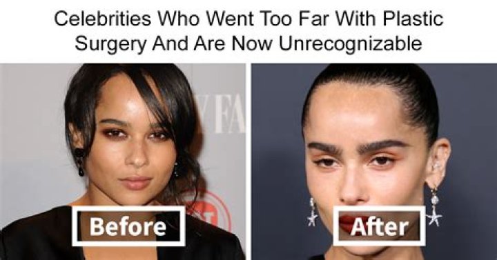 Chloe Bailey Weight Gain Viral On Tiktok: Plastic Surgery Before And After