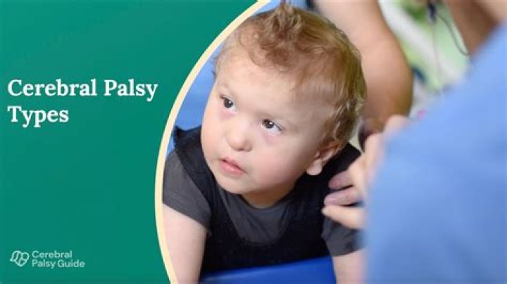 Does Paul Reiser’s son have cerebral palsy?