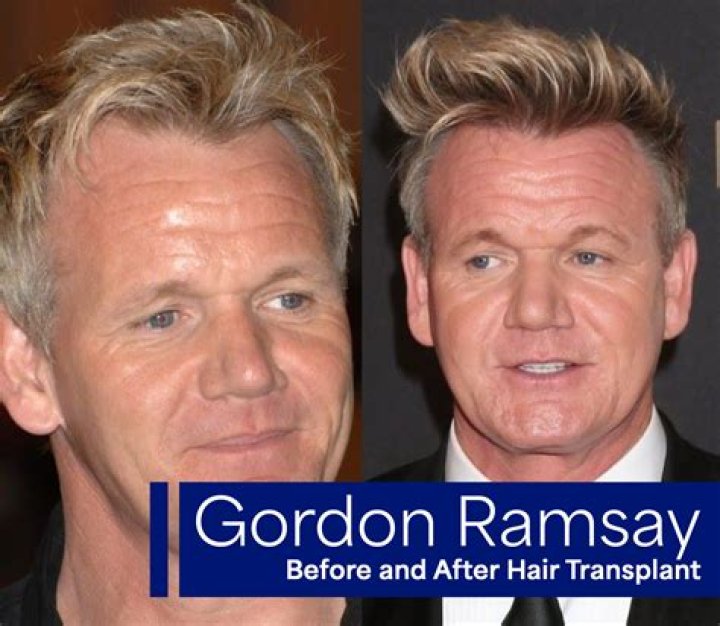 Is Mason Ramsey Related To Gordon Ramsay? Relationship Explained